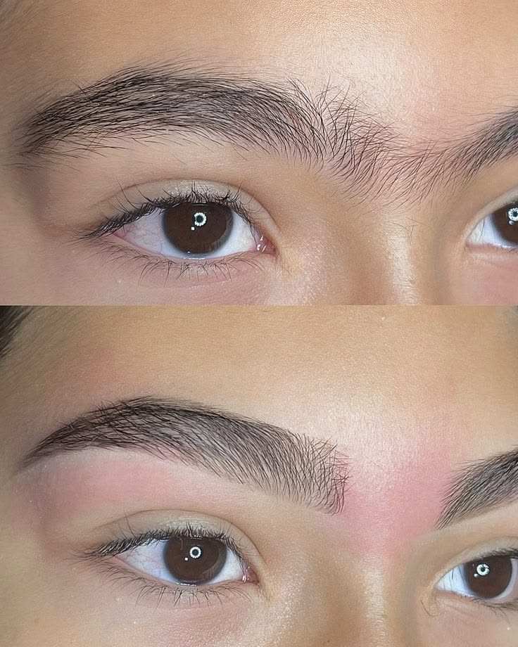 Antes e depois de micropigmentação fio a fio